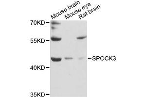 Western blot analysis of extracts of various cell lines, using SPOCK3 antibody (ABIN6292517) at 1:3000 dilution. (SPOCK3 antibody)