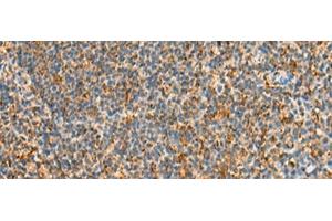 Immunohistochemistry of paraffin-embedded Human tonsil tissue using STK32C Polyclonal Antibody at dilution of 1:40(x200) (STK32C antibody)