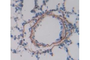 IHC-P analysis of Rat Tissue, with DAB staining. (Tissue factor antibody  (AA 30-252))