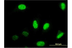 Immunofluorescence of monoclonal antibody to NFIB on HeLa cell.