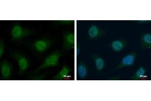 ICC/IF Image TrxR1 antibody detects TrxR1 protein at cytoplasm and nucleus by immunofluorescent analysis. (TXNRD1 antibody)
