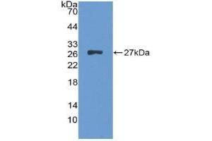 Detection of Recombinant ALT, Human using Polyclonal Antibody to Alanine Aminotransferase (ALT) (ALT antibody  (AA 255-492))