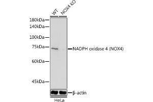 Western blot analysis of extracts from normal (control) and NADPH oxidase 4 (NOX4) Rabbit pAb knockout (KO) HeLa cells, using NADPH oxidase 4 (NOX4) Rabbit pAb antibody (ABIN6128328, ABIN6144752, ABIN6144753 and ABIN6215143) at 1:1000 dilution. (NADPH Oxidase 4 antibody  (AA 328-578))