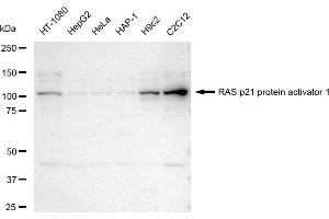 Western blotting analysis using RAS p21 protein activator 1 antibody (ABIN7800111). (Recombinant RACGAP1 antibody)