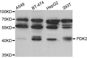 Western blot analysis of extracts of various cell lines, using PDK2 antibody. (PDK2 antibody)