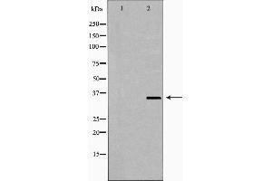 Western blot analysis of extracts of Jurkat using NUDT6 Antibody. (NUDT6 antibody  (Internal Region))
