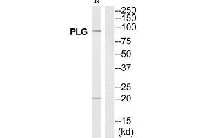 Western Blotting (WB) image for anti-Plasminogen (PLG) (N-Term) antibody (ABIN1852803) (PLG antibody  (N-Term))