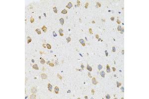 Immunohistochemistry of paraffin-embedded mouse brain using TGM2 antibody. (Transglutaminase 2 antibody)