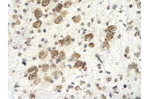 Rabbit Anti-PSMD4 Antibody       Paraffin Embedded Tissue:  Human neural cell   Cellular Data:  Epithelial cells of renal tubule  Antibody Concentration:   4. (PSMD4/ASF antibody  (C-Term))