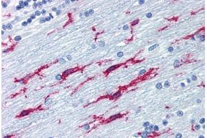 Human Brain, Cerebellum (formalin-fixed, paraffin-embedded) stained with ITGB2 antibody ABIN298664 at 10 ug/ml followed by biotinylated anti-mouse IgG secondary antibody ABIN481714, alkaline phosphatase-streptavidin and chromogen. (Integrin beta 2 antibody)
