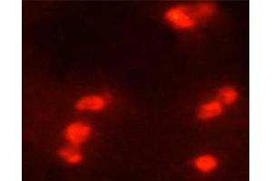 Immunofluorescence (fixed cells) (IF/ICC) image for anti-Histone 3 (H3) (H3K9ac) antibody (ABIN6254904)