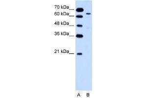 KRT2A antibody used at 0. (Keratin 2 antibody  (Middle Region))