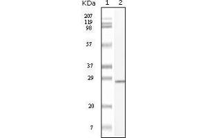 Western blot analysis using C-kit mouse mAb against truncated C-kit recombinant protein. (KIT antibody)