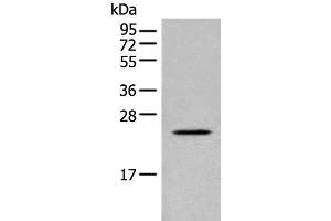 Western blot analysis of Human placenta tissue lysate using CARD16 Polyclonal Antibody at dilution of 1:800 (CARD16 antibody)