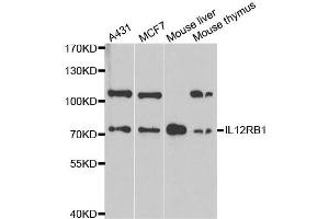 Western Blotting (WB) image for anti-Interleukin 12 Receptor beta 1 (IL12RB1) antibody (ABIN1980210) (IL12RB1 antibody)