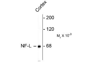 Western blots of rat cortex lysate showing specific immunolableing of the ~ 68k NF-L protein. (NEFL antibody)