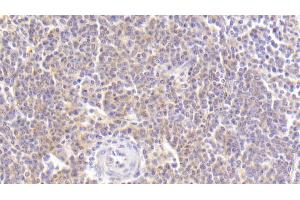 Detection of MDC in Human Spleen Tissue using Polyclonal Antibody to Macrophage Derived Chemokine (MDC) (CCL22 antibody  (AA 25-93))