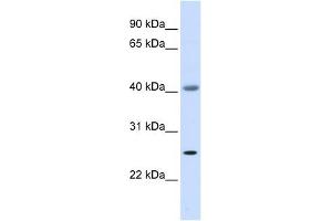 ADA antibody used at 1 ug/ml to detect target protein. (ADA antibody  (Middle Region))