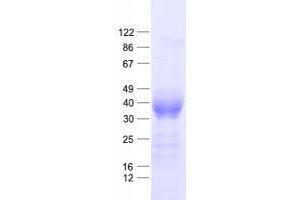 Validation with Western Blot (CHIA Protein (His tag))