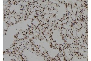 ABIN6279634 at 1/100 staining Rat lung tissue by IHC-P. (ZCCHC17 antibody  (Internal Region))