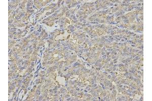 Immunohistochemistry (IHC) image for anti-Proteasome (Prosome, Macropain) 26S Subunit, Non-ATPase, 7 (PSMD7) antibody (ABIN1876544) (PSMD7 antibody)