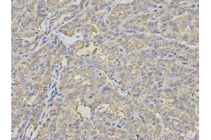 Immunohistochemistry (IHC) image for anti-Proteasome (Prosome, Macropain) 26S Subunit, Non-ATPase, 7 (PSMD7) antibody (ABIN1876544) (PSMD7 antibody)