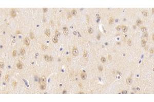 Detection of SNUPN1 in Mouse Cerebrum Tissue using Polyclonal Antibody to Snurportin 1 (SNUPN1) (Snurportin 1 antibody  (AA 1-329))