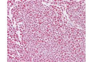 Anti-TARDBP antibody IHC of human thymus. (TARDBP antibody  (AA 252-301))