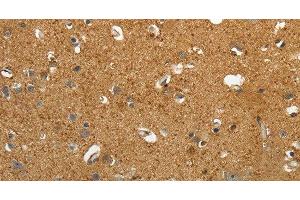 Immunohistochemistry of paraffin-embedded Human brain tissue using AKAP12 Polyclonal Antibody at dilution 1:40 (AKAP12 antibody)