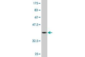 Western Blot detection against Immunogen (36. (CAMKK1 antibody  (AA 2-100))