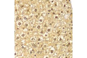 Immunohistochemistry of paraffin-embedded mouse liver using PYCARD antibody (ABIN5998640) at dilution of 1/100 (40x lens). (PYCARD antibody)
