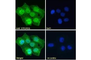 ABIN185681 Immunofluorescence analysis of paraformaldehyde fixed A431 cells, permeabilized with 0. (GTF2IRD1 antibody  (Internal Region))