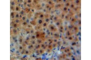 Used in DAB staining on fromalin fixed paraffin-embedded liver tissue (GLN1 antibody  (AA 1-373))