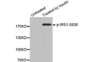 Western blot analysis of extracts from 3T3 cells, using Phospho-IRS1-S636 antibody. (IRS1 antibody  (pSer636))