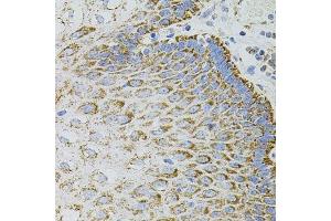 Immunohistochemistry of paraffin-embedded human esophagus using EPO antibody. (EPO antibody)