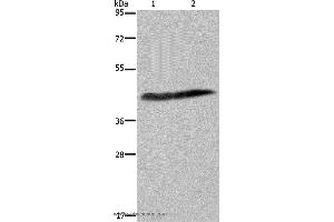 Western blot analysis of Human placenta tissue and HepG2 cell, using CSF2RA Polyclonal Antibody at dilution of 1:250 (CSF2RA antibody)