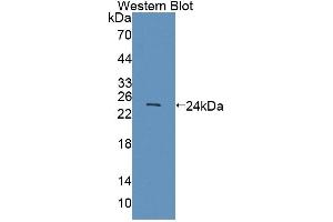 Detection of Recombinant SCCA1/SCCA2, Human using Polyclonal Antibody to Squamous Cell Carcinoma Antigen 1/2 (SCCA1/SCCA2) (Squamous Cell Carcinoma Antigen 1/2 (AA 211-390) antibody)