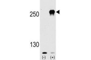 Western blot analysis of mTOR antibody and 293 cell lysate (2 ug/lane) either nontransfected (Lane 1) or transiently transfected with the mTOR gene (2). (MTOR antibody  (AA 2459-2488))