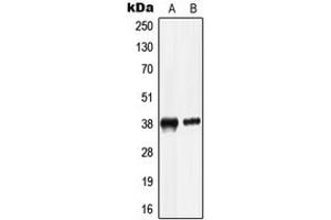 Western blot analysis of LRG expression in HepG2 (A), HL60 (B) whole cell lysates. (LRG1 antibody  (C-Term))