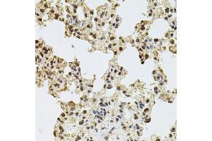 Immunohistochemistry of paraffin-embedded rat lung using ZNF408 antibody. (ZNF408 antibody  (AA 471-720))