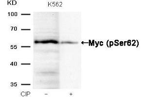 Western blot analysis of extracts from K562 cells, treated with calf intestinal phosphatase (CIP), using Myc (Phospho-Ser62) Antibody. (c-MYC antibody  (pSer62))