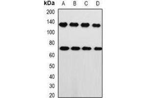 Western blot analysis of PRKG1 expression in A549 (A), PC3 (B), mouse lung (C), mouse heart (D) whole cell lysates. (PRKG1 antibody)