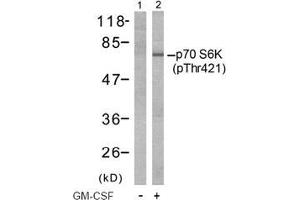 Image no. 2 for anti-Ribosomal Protein S6 Kinase, 70kDa, Polypeptide 1 (RPS6KB1) (pThr421) antibody (ABIN197014) (RPS6KB1 antibody  (pThr421))