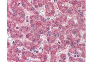 Immunohistochemistry (IHC) image for anti-Coagulation Factor II (thrombin) (F2) (Middle Region) antibody (ABIN2776976) (Prothrombin antibody  (Middle Region))