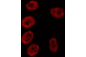 ABIN6276885 staining HepG2? (GADD45A antibody  (N-Term))