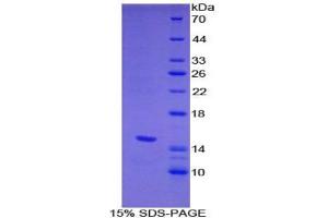 SDS-PAGE of Protein Standard from the Kit  (Highly purified E. (HPSE ELISA Kit)