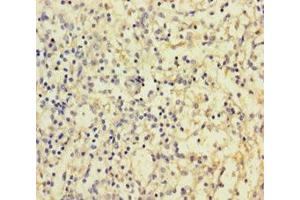 Immunohistochemistry of paraffin-embedded human spleen tissue using ABIN7147970 at dilution of 1:100 (IREM1 antibody  (AA 20-156))