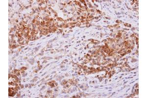 Immunohistochemistry (IHC) image for anti-Phosphogluconate Dehydrogenase (PGD) antibody (ABIN2855133)