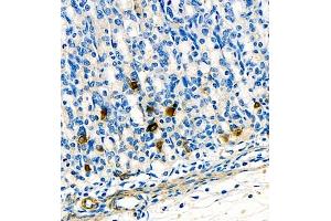 Immunohistochemistry of paraffin embedded rat stomach using ghrelin (ABIN7074040) at dilution of 1:1500 (400x lens) (Ghrelin antibody)