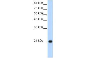 RPL9 antibody used at 1. (RPL9 antibody  (C-Term))